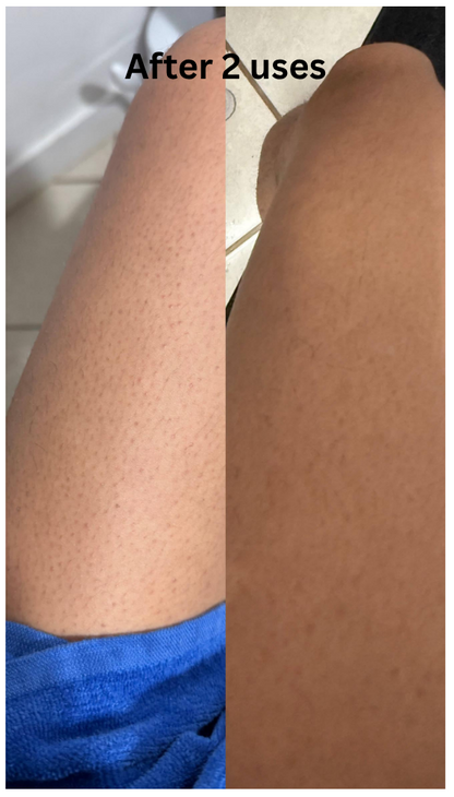 Everyday Glow Duo (Turmeric Scrub + Brightening Body Butter)